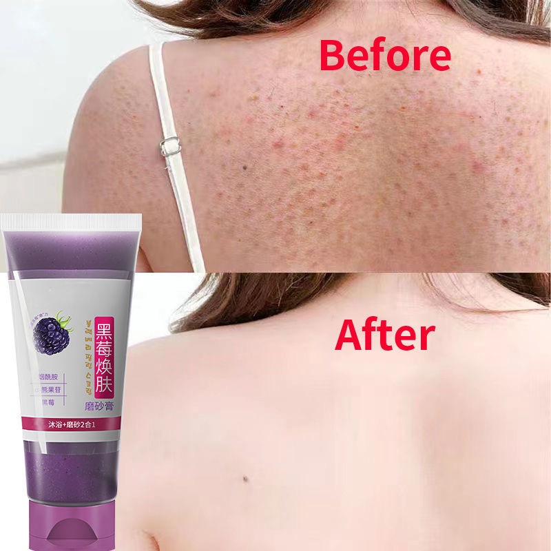 200g Blackberries Whitening Exfoliating Body Scrub Melamine Body Brightening Anti Aging Cleaning Pimple Dry Skin